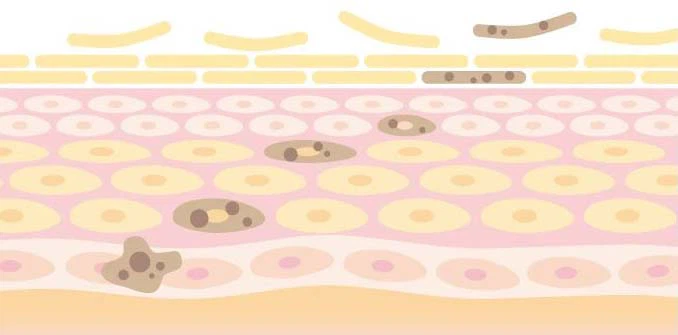 tranexamic acid-4 tranexamic acid-4